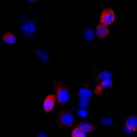 Filamin B Rabbit Polyclonal Antibody