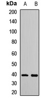 IRF2 Rabbit Polyclonal Antibody