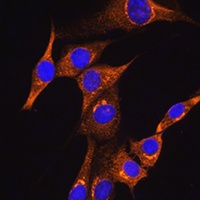 BDKRB2 Rabbit Polyclonal Antibody