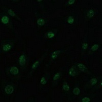 PELP1 Rabbit Polyclonal Antibody