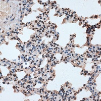 RBM17 Antibody