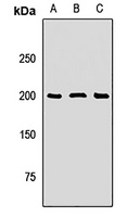 SOS1 Rabbit Polyclonal Antibody