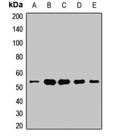 UQCRC1 Rabbit Polyclonal Antibody
