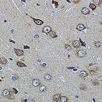 UQCRC1 Rabbit Polyclonal Antibody