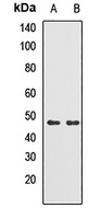 TRMT2B Rabbit Polyclonal Antibody