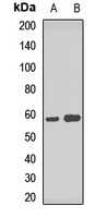 ATP6V1B2 Rabbit Polyclonal Antibody