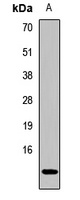 CKS2 Rabbit Polyclonal Antibody