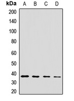 CPOX Rabbit Polyclonal Antibody