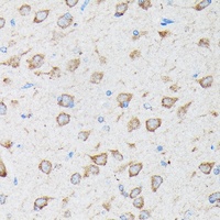 CYLD Antibody