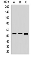 FDXR Rabbit Polyclonal Antibody