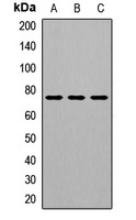 GALC Rabbit Polyclonal Antibody