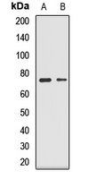 GLS Rabbit Polyclonal Antibody