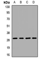 PGAM1 Rabbit Polyclonal Antibody