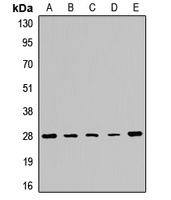 PMM2 Rabbit Polyclonal Antibody