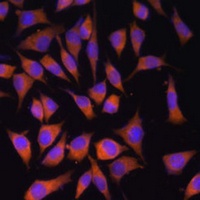 PMM2 Rabbit Polyclonal Antibody