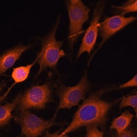 RNH1 Rabbit Polyclonal Antibody