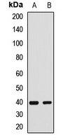 SH3GL3 Rabbit Polyclonal Antibody