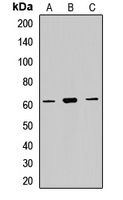 P4HA2 Rabbit Polyclonal Antibody