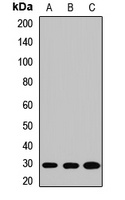 SNAP29 Rabbit Polyclonal Antibody
