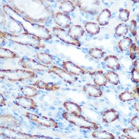 LONP1 Rabbit Polyclonal Antibody