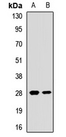 EIF4E2 Rabbit Polyclonal Antibody