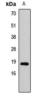 SAP18 Rabbit Polyclonal Antibody