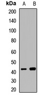 ADRM1 Rabbit Polyclonal Antibody