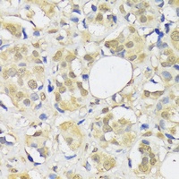 ADRM1 Rabbit Polyclonal Antibody