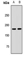 PTPN23 Rabbit Polyclonal Antibody