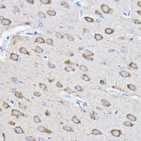 PTPN23 Rabbit Polyclonal Antibody