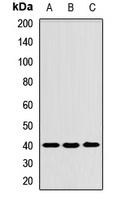 Tropomodulin-3 Rabbit Polyclonal Antibody