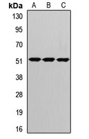 CRBN Rabbit Polyclonal Antibody