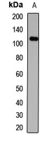 HAUS6 Rabbit Polyclonal Antibody