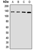 CC2D1A Rabbit Polyclonal Antibody
