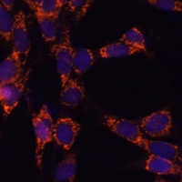 UBE2F Antibody