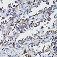 GSTK1 Rabbit Polyclonal Antibody