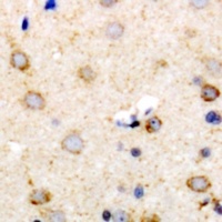 CD63 Rabbit Polyclonal Antibody