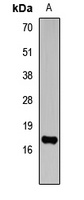 Histone H3 (TriMethyl-K14) Antibody