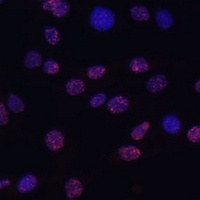 Histone H3 (TriMethyl-K14) Antibody
