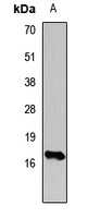 Histone H3 (TriMethyl-K14) Antibody