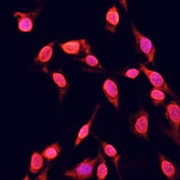 Histone H3 (TriMethyl-K14) Antibody