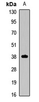 PAX4 Rabbit Polyclonal Antibody
