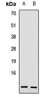 PI3 Rabbit Polyclonal Antibody