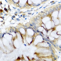 PI3 Rabbit Polyclonal Antibody