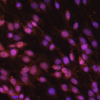 FUBP1 Rabbit Polyclonal Antibody