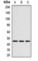 Serpin A6 Rabbit Polyclonal Antibody