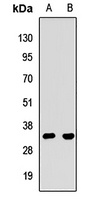 SBDS Rabbit Polyclonal Antibody