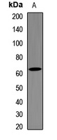 Metadherin Rabbit Polyclonal Antibody