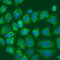 Metadherin Rabbit Polyclonal Antibody