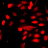 TRIM69 Rabbit Polyclonal Antibody